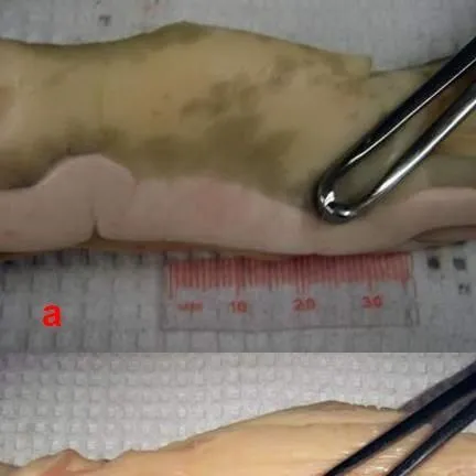 thumbnail for publication: Sturgeon Aquaculture—Specialized Techniques: Determining the Sex of Sturgeon by Direct Examination of the Gonad Using a Minimally Invasive Surgical Procedure